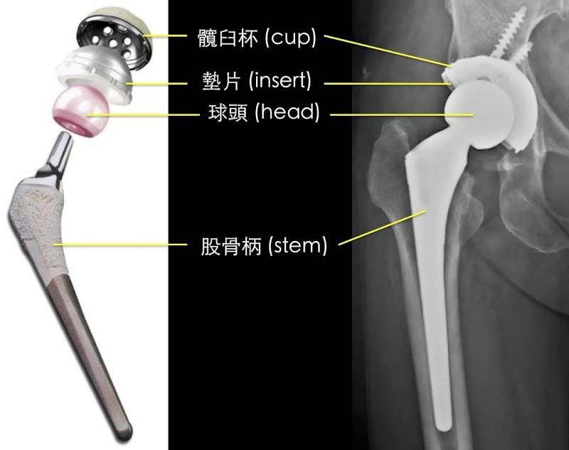 Zirconia Ceramic Bones Replacement1